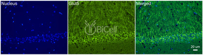 GLUT5 (SLC2A5) Antibody