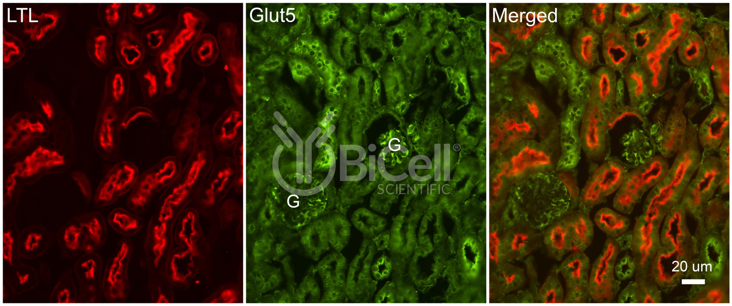 GLUT5 (SLC2A5) Antibody - FFPE Validated