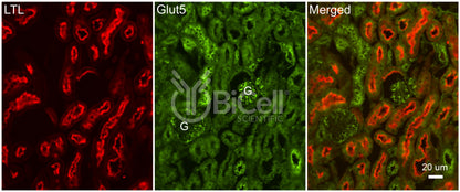 GLUT5 (SLC2A5) Antibody - FFPE Validated