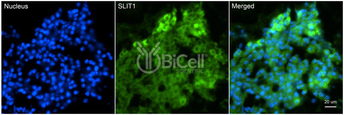 SLIT1 Antibody - Western Blot Validated