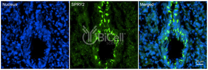 SPRY2 Antibody