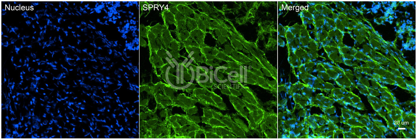 SPRY4 (HH17) Antibody - FFPE Validated