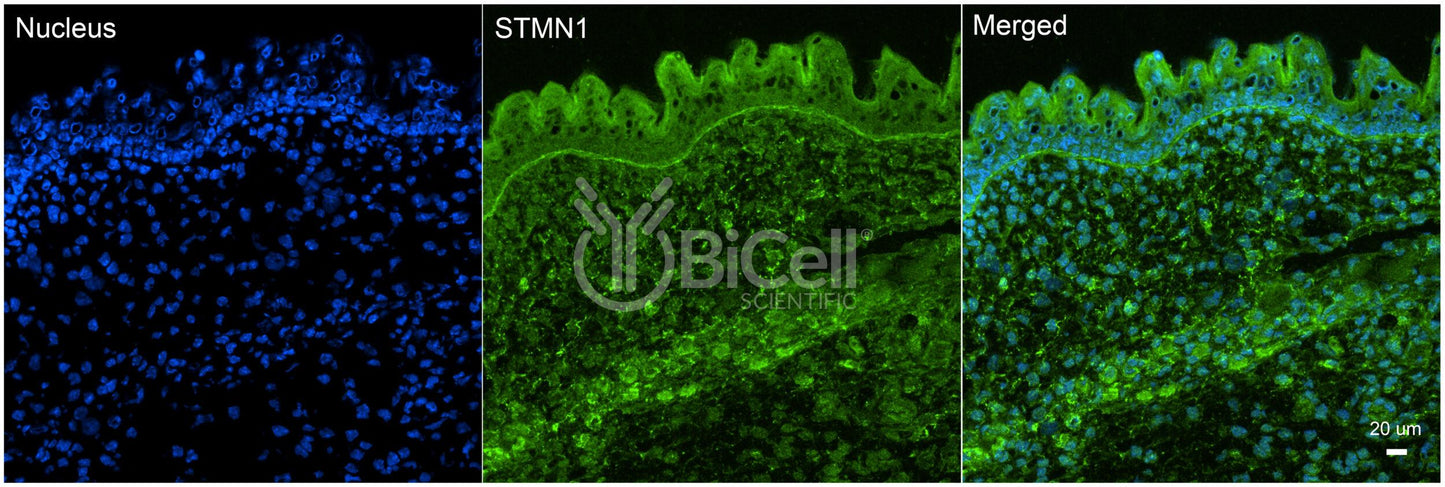 Stathmin (Stathmin-1 or STMN1) Antibody - Western Blot Validated