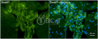 SWELL1 (LRRC8A) Antibody - FFPE Validated