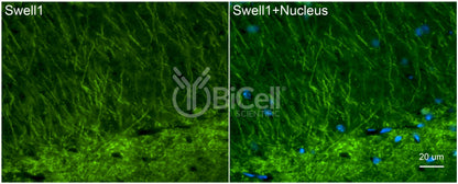 SWELL1 (LRRC8A) Antibody - FFPE Validated