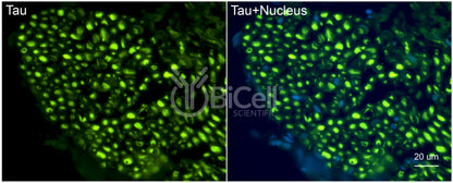 Tau (MAPT) Antibody - Western Blot Validated