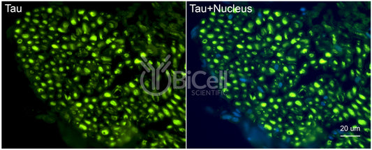 Tau (MAPT) Antibody