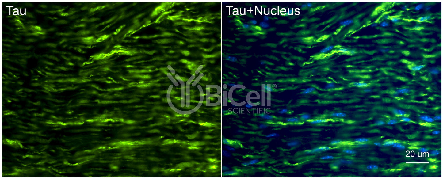 Tau (MAPT) Antibody - Western Blot Validated