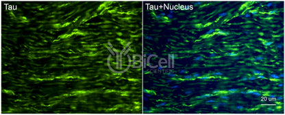 Tau (MAPT) Antibody - Western Blot Validated