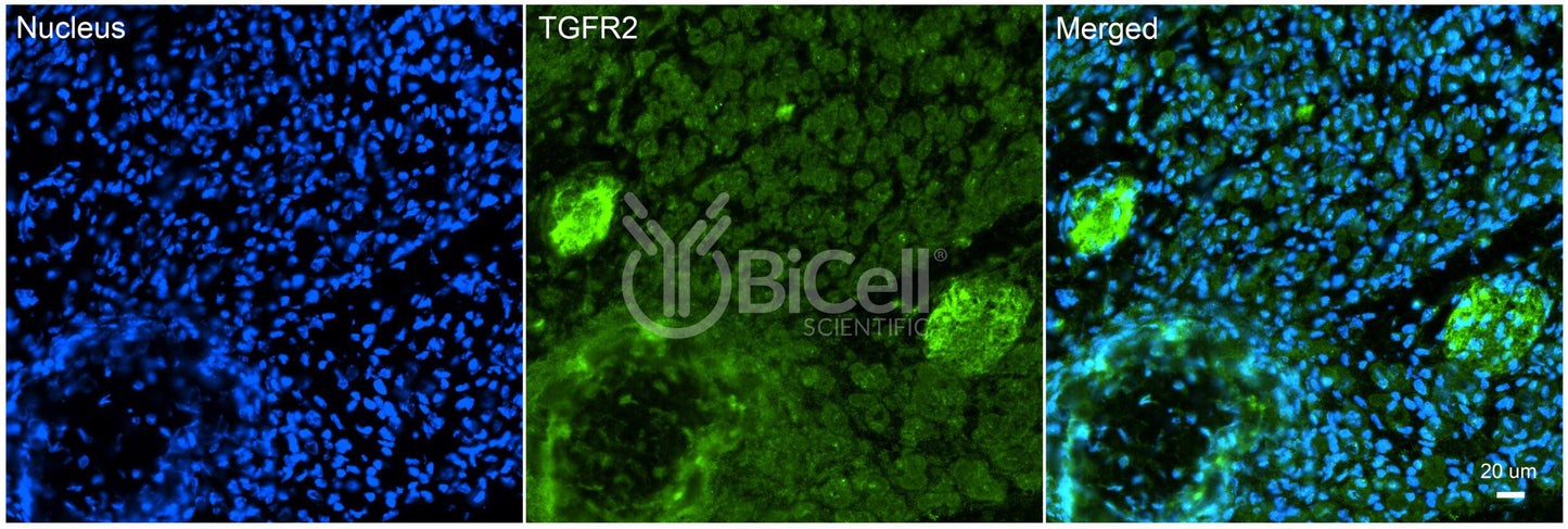 TGFBR2 (TGFR2) Antibody - FFPE Validated
