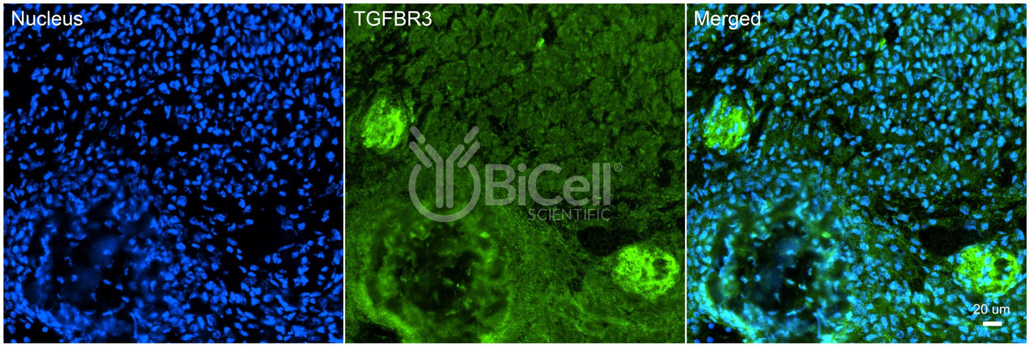 TGFBR3 Antibody - FFPE Validated