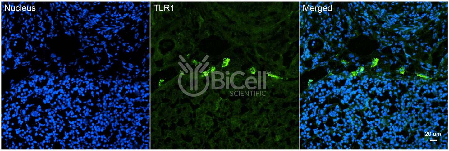 Toll-like receptor 1 (TLR1 or CD281) Antibody