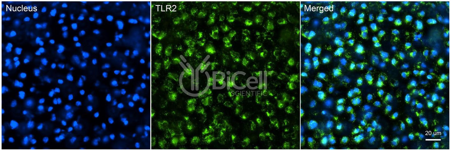 Toll-like receptor 2 (TLR2 or CD282) Antibody - Western Blot Validated