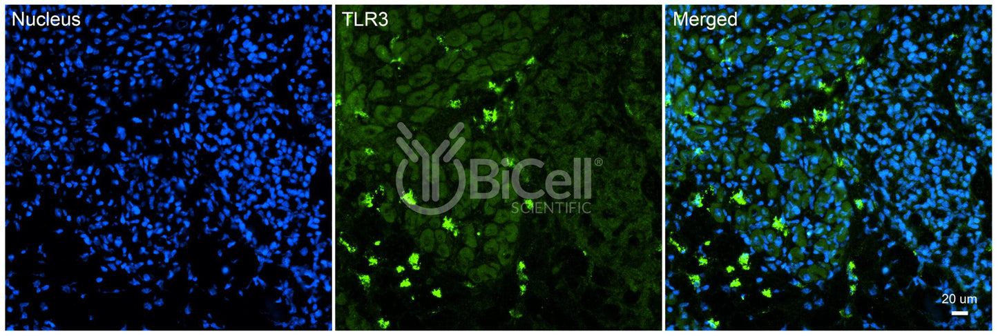 Toll-like receptor 3 (TLR3 or CD283) Antibody - Western Blot Validated