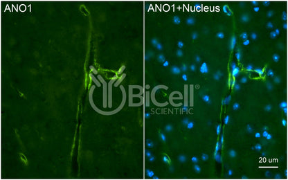 Anoctamin-1 (ANO1 or TMEM16A) (C-Terminus) Antibody