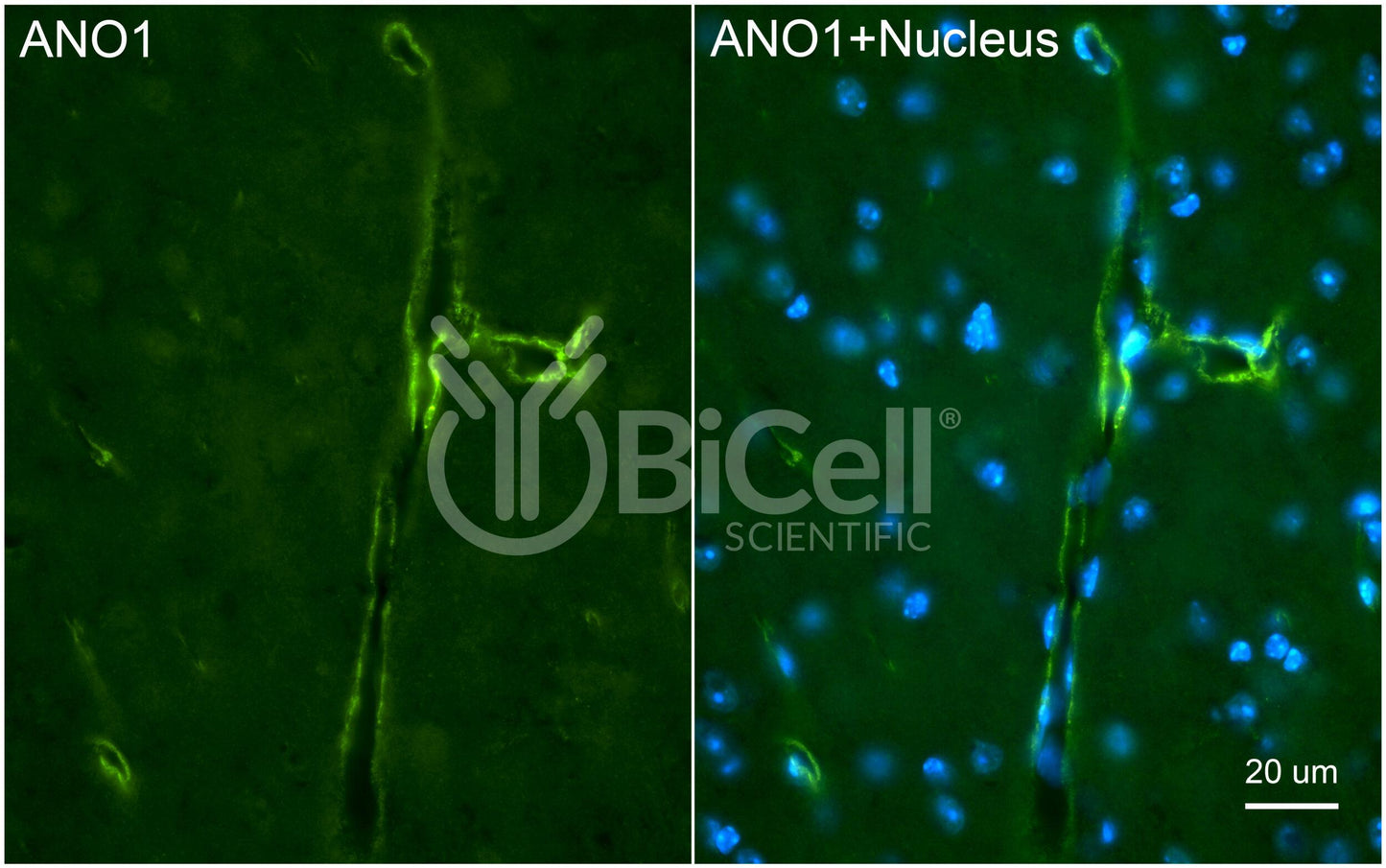 Anoctamin-1 (ANO1 or TMEM16A) (C-Terminus) Antibody - FFPE Validated