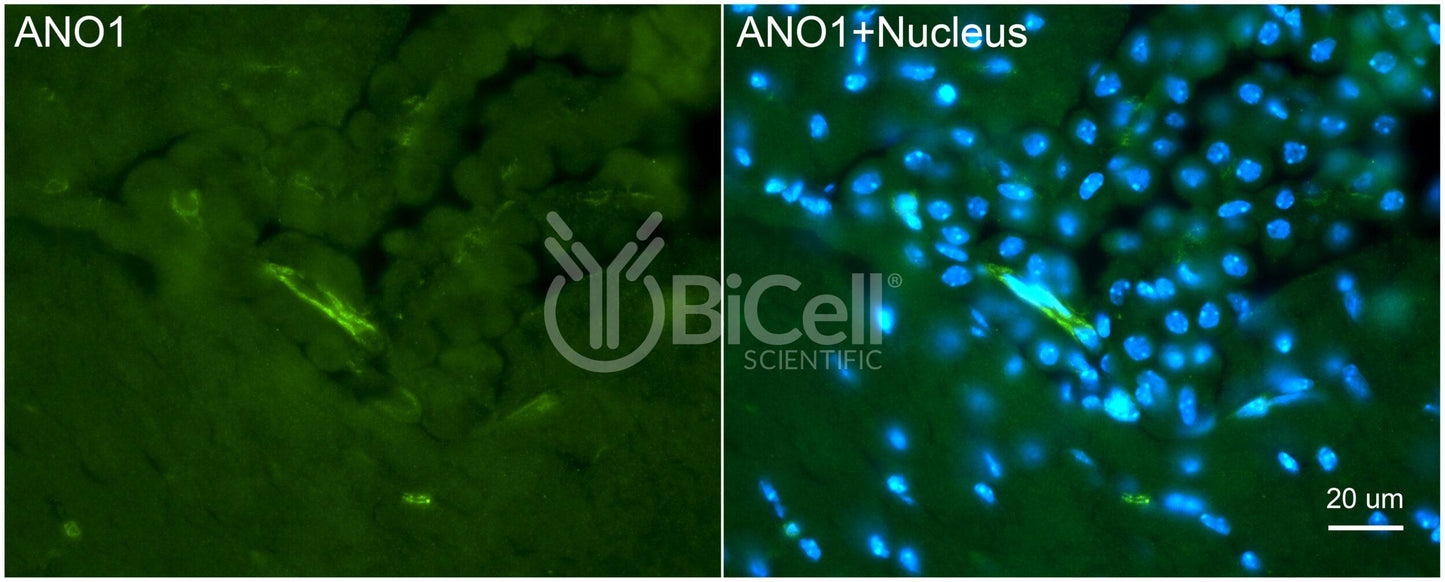 Anoctamin-1 (ANO1 or TMEM16A) (C-Terminus) Antibody - FFPE Validated