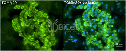 TOMM20 (MAS20) Antibody