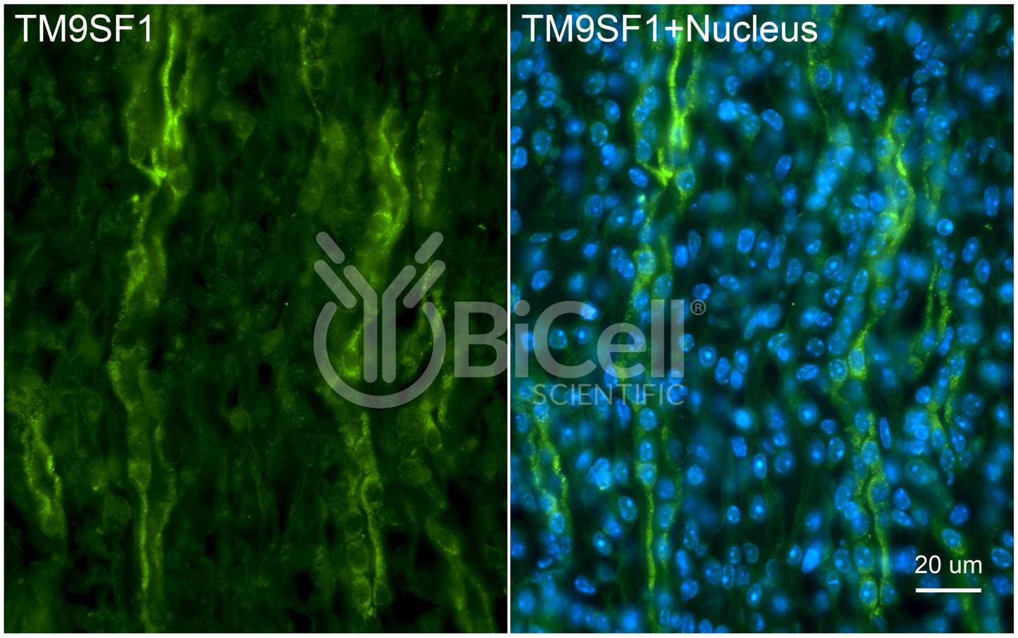 TM9SF1 Antibody - FFPE Validated