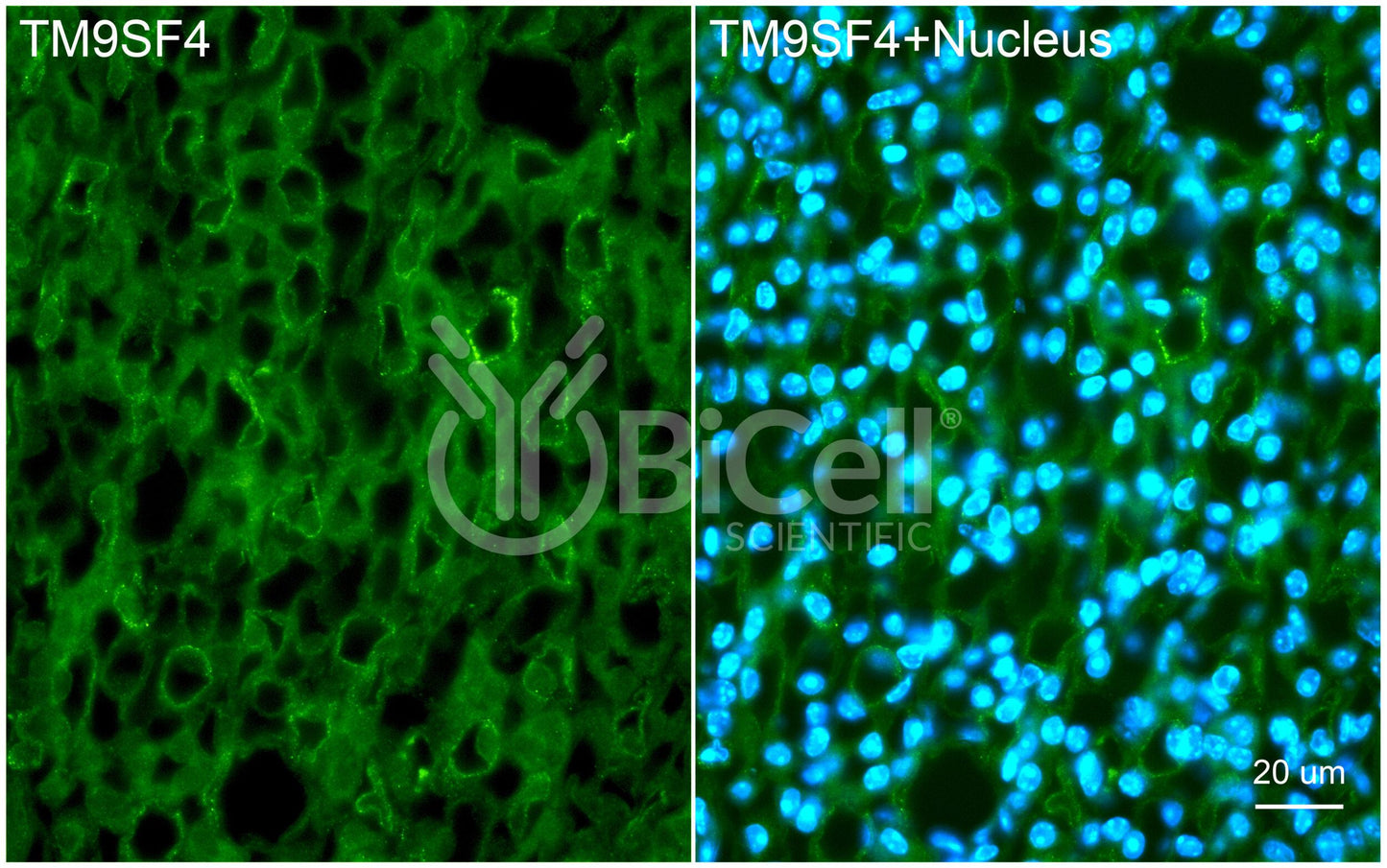 TM9SF4 Antibody