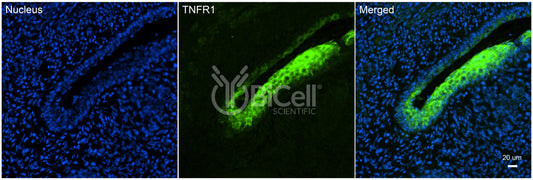 TNFRSF1A (TNFR1 or CD120a) Antibody