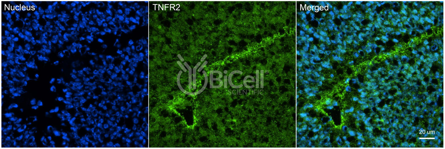 TNFRSF1B (TNFR2 or CD120b) Antibody - FFPE Validated