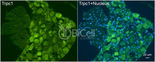 Trpc1 Antibody - FFPE Validated