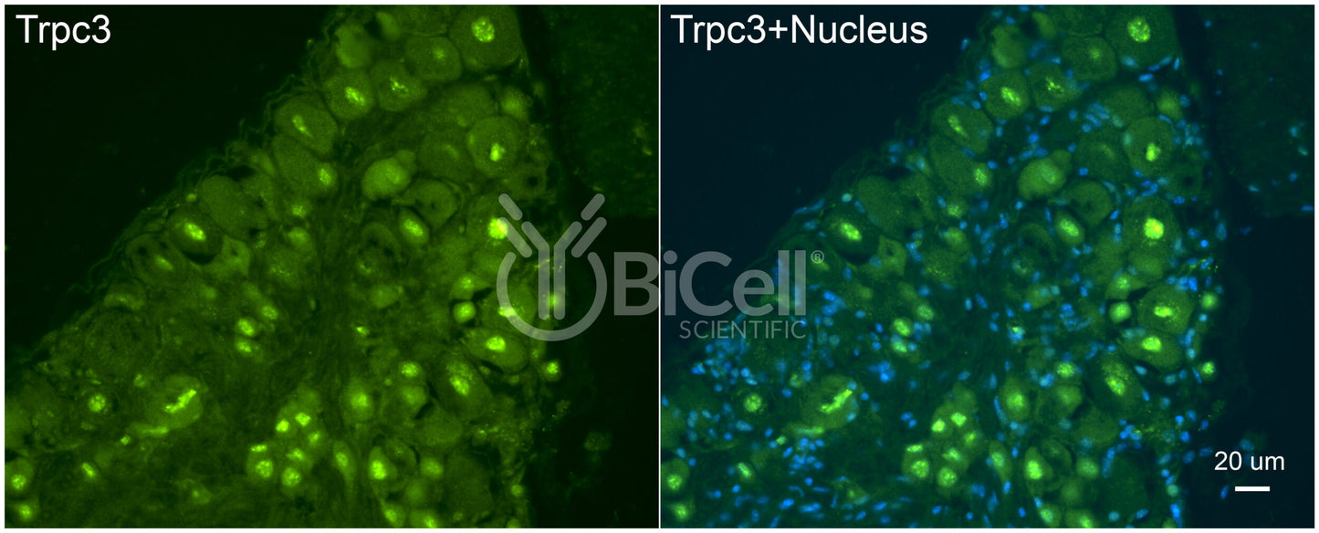 Trpc3 Antibody - FFPE Validated
