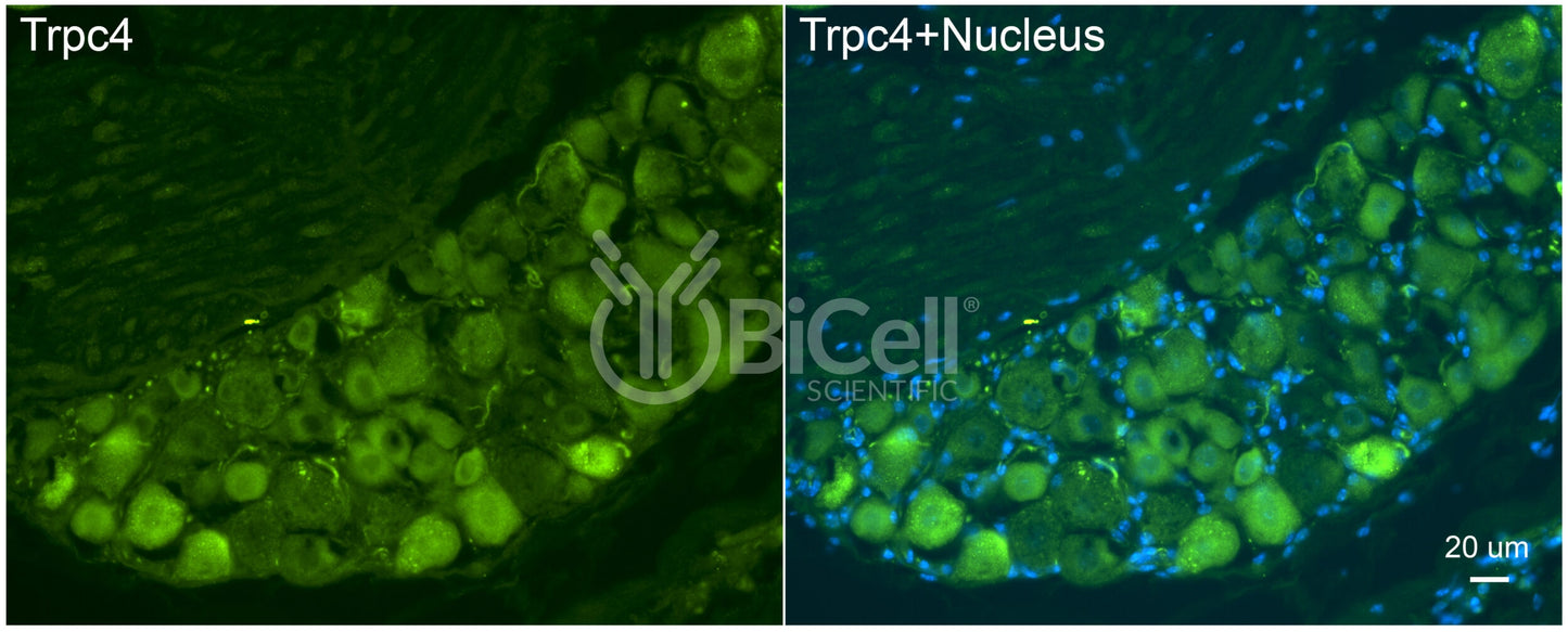 Trpc4 Antibody - FFPE Validated