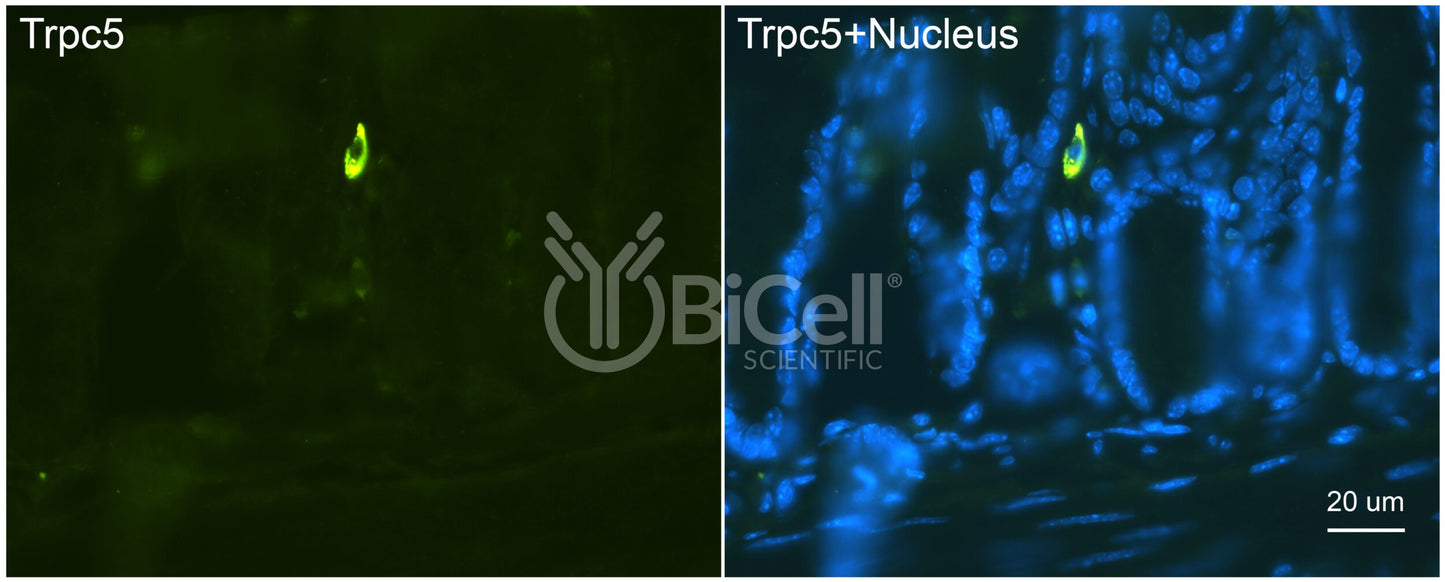 Trpc5 (N-Terminus) Antibody - FFPE Validated