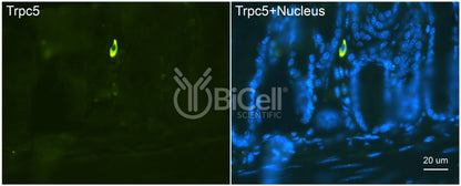 Trpc5 (N-Terminus) Antibody
