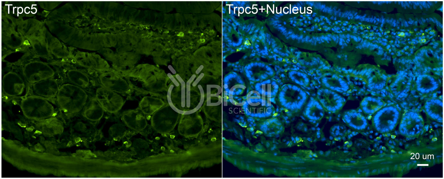 Trpc5 (N-Terminus) Antibody - FFPE Validated