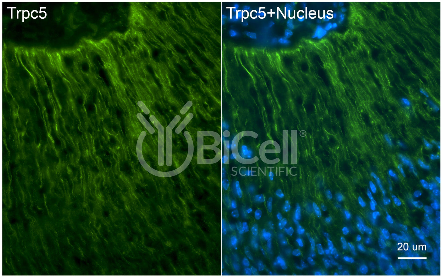 Trpc5 (C-Terminus) Antibody - FFPE Validated