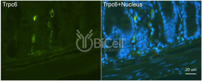 Trpc6 (C-Terminus) Antibody