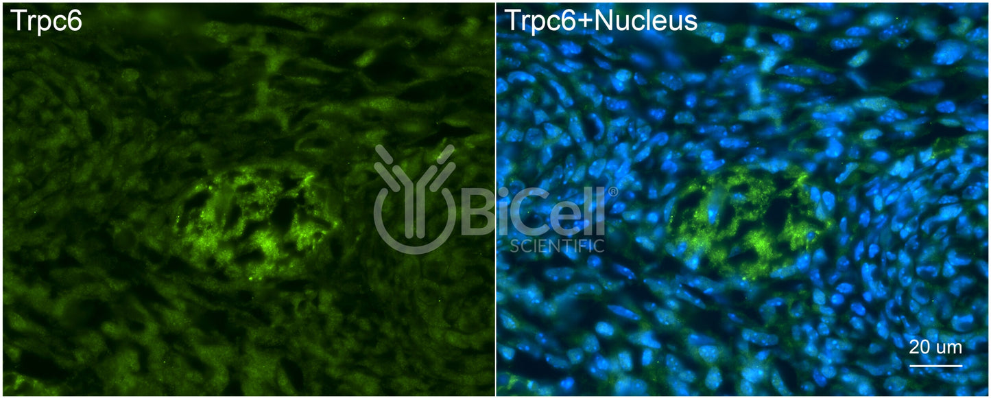 Trpc6 (N-Terminus) Antibody