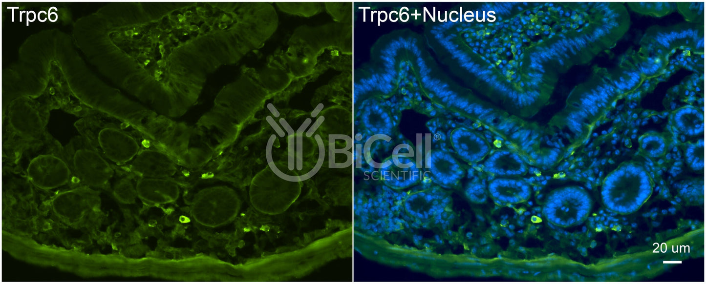 Trpc6 (C-Terminus) Antibody - FFPE Validated