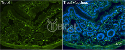 Trpc6 (C-Terminus) Antibody
