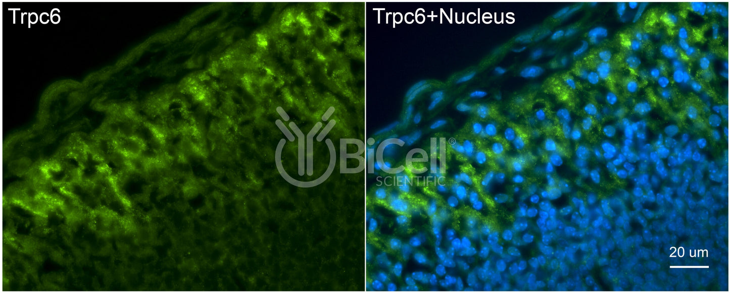 Trpc6 (N-Terminus) Antibody - Western Blot Validated
