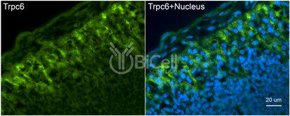 Trpc6 (N-Terminus) Antibody - Western Blot Validated