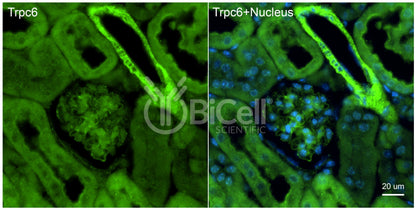 Trpc6 (N-Terminus) Antibody