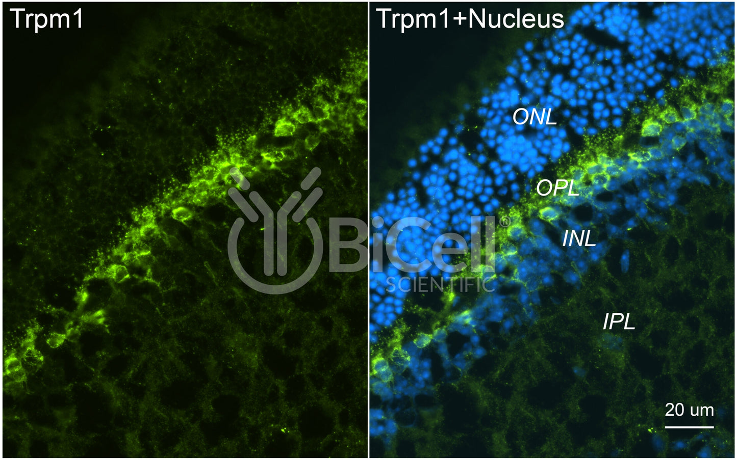 Trpm1 Antibody - Western Blot Validated