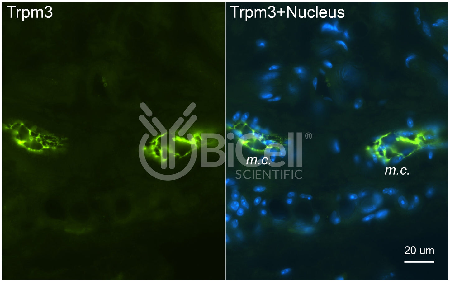 Trpm3 Antibody - Western Blot Validated