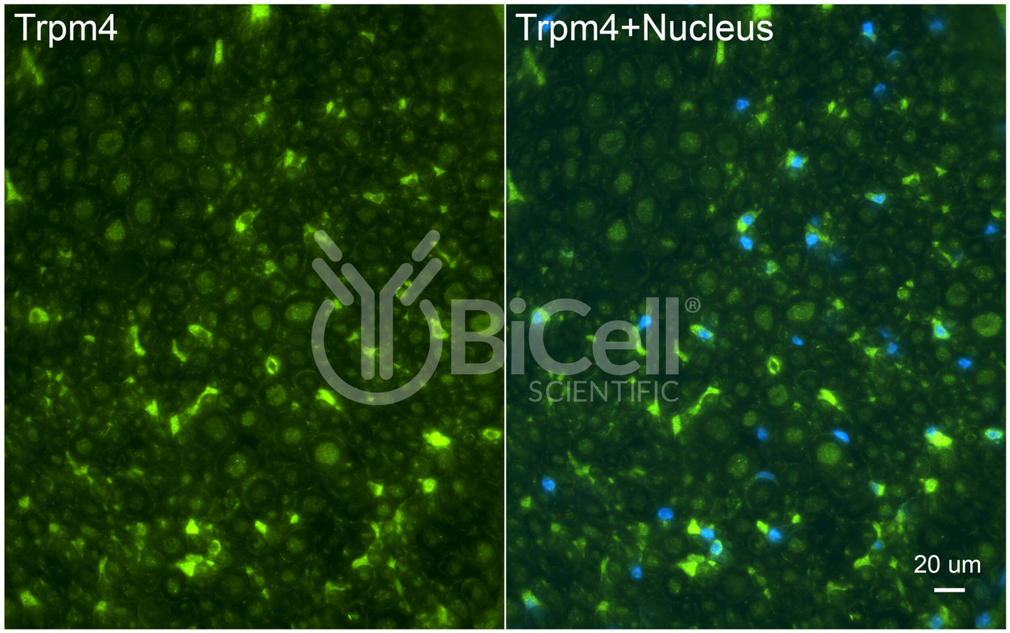 Trpm4 Antibody