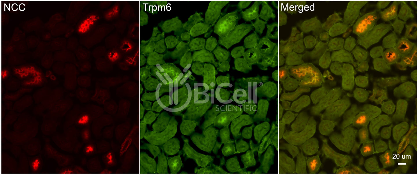 Trpm6 Antibody