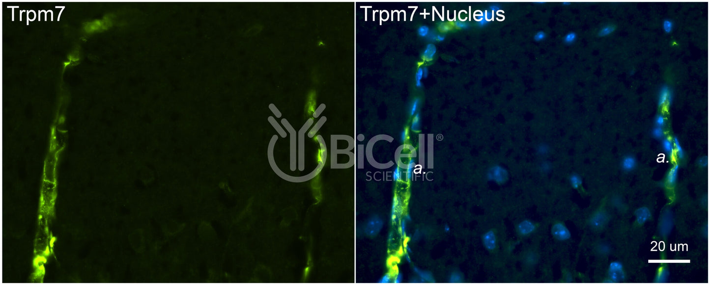 Trpm7 Antibody - Western Blot Validated