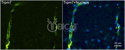 Trpm7 Antibody - FFPE Validated