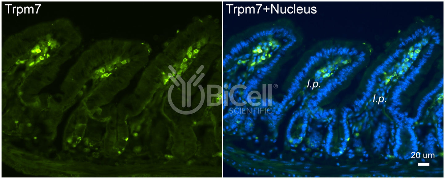 Trpm7 Antibody - FFPE Validated