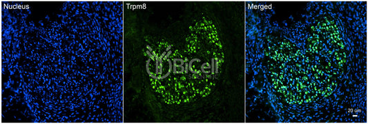 Trpm8 Antibody