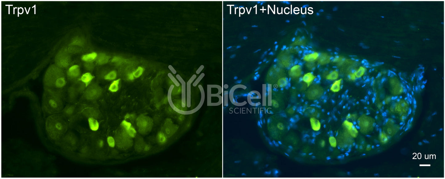 Trpv1 Antibody