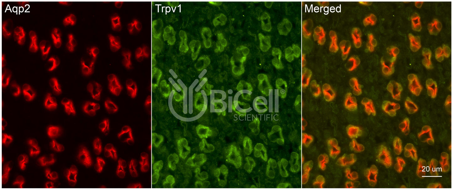 Trpv1 Antibody